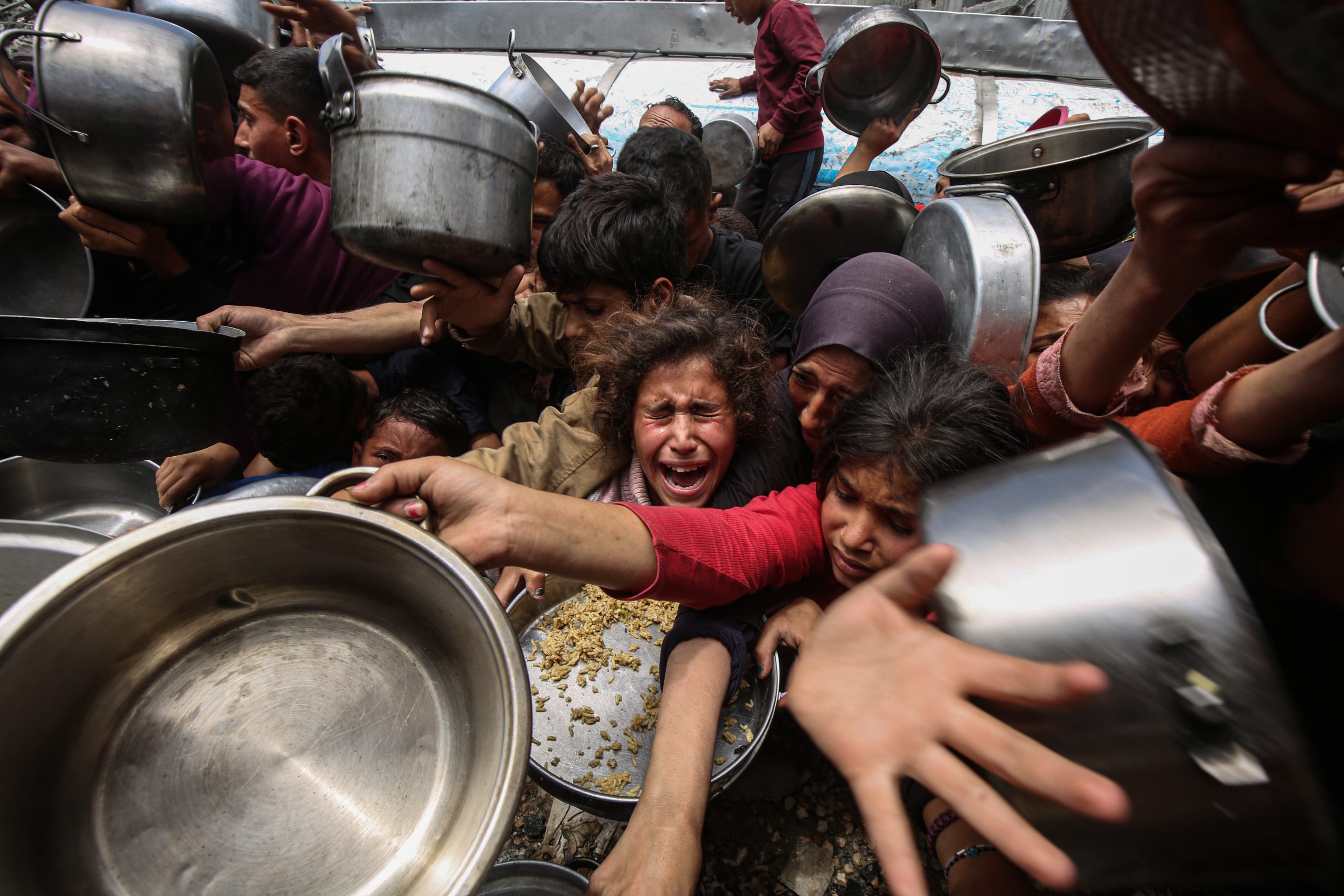 Israel’s Starvation Policy Is Ravaging Women and Children in Gaza Strip