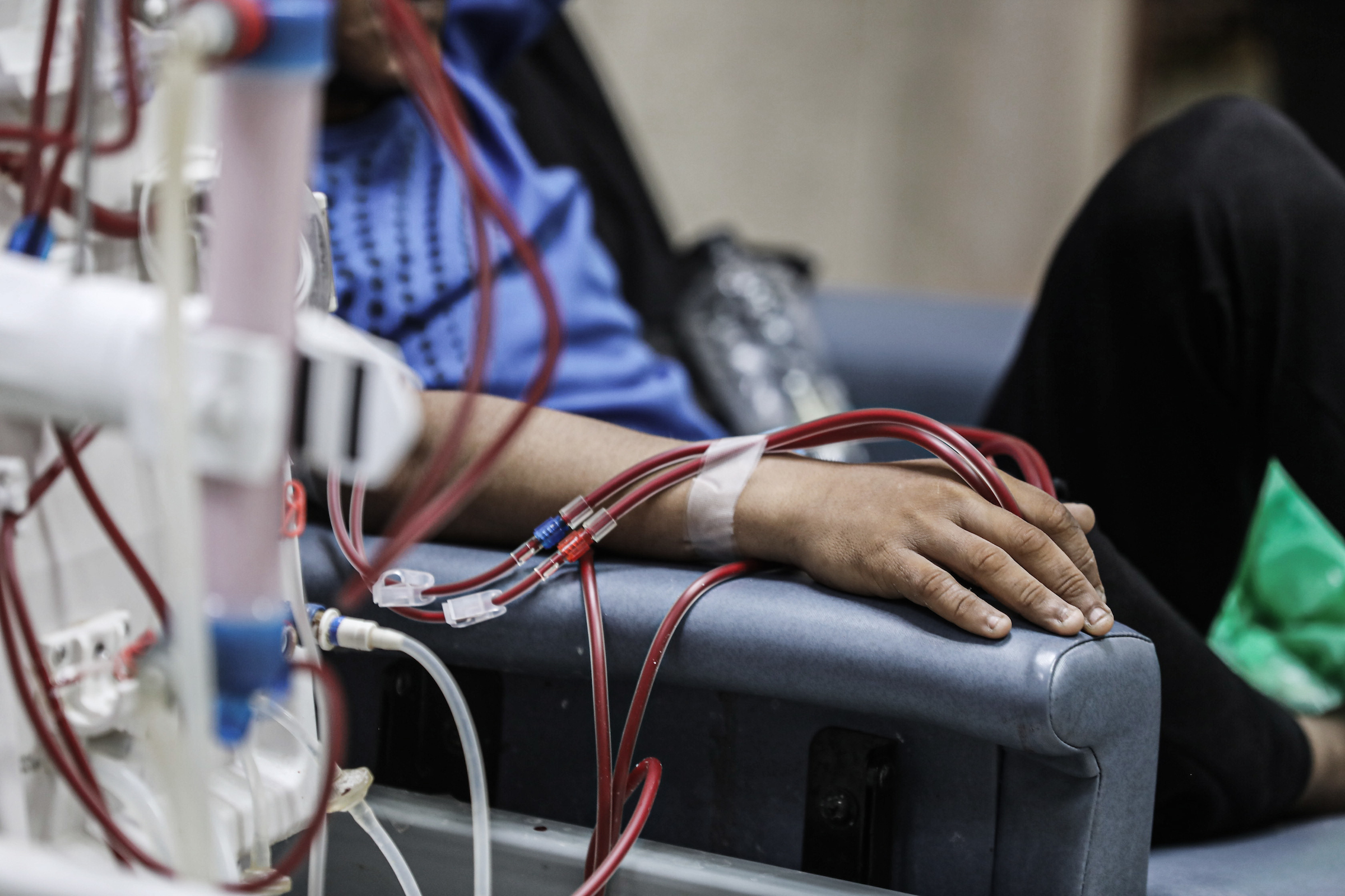 Another Chapter in the Policy of Comprehensive Medical Strangulation in the Gaza Strip: Depletion of Sodium Bicarbonate Threatens the Lives of 650 Kidney Failure Patients
